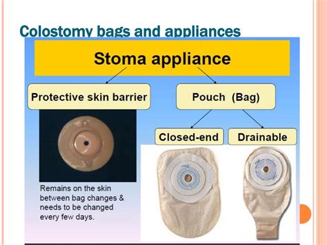 Stoma