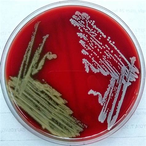 Streptococcus Pneumoniae Left Exhibiting Alpha
