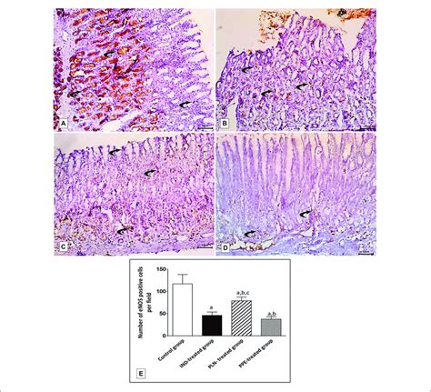 Photomicrographs Of Immunohistochemical Staining Of E Nos In Fundic