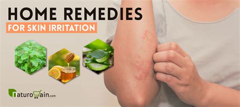 9 Outstanding Home Remedies For Skin Irritation And Redness [that Work]