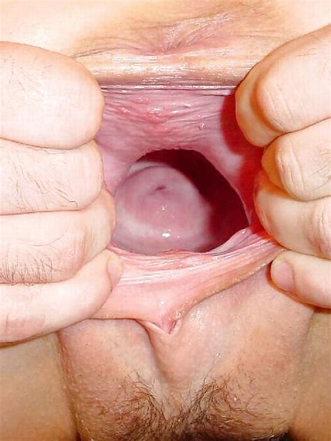 Extreme Pussy Insertions Fisting Bottle Londonlad Pics