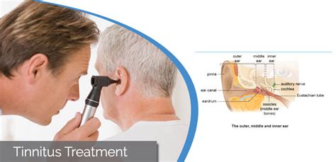 Tinnitus Treatment Best Tinnitus Treatment Nyc
