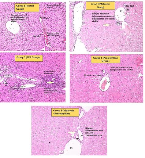 Mouse Liver Histology At 20x Of All Groups Labelled Pv Portal Vein