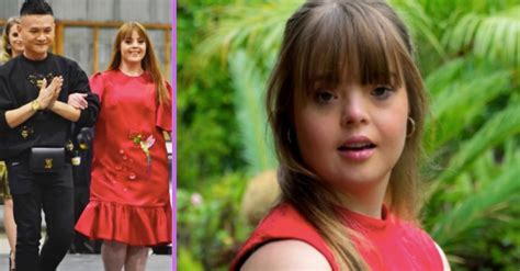 Model With Down Syndrome Katie Harris Gets To Walk The Catwalk