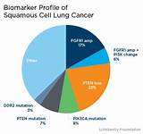 Genetic Lung Cancer Treatment Photos