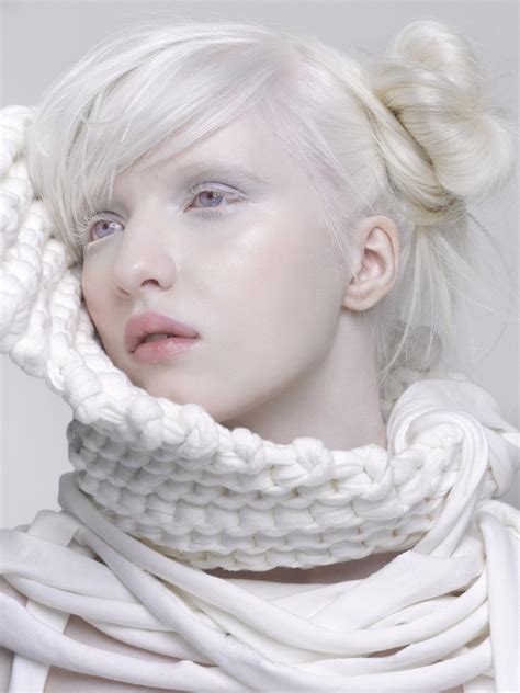 Albino Girl Albino Model Albinism