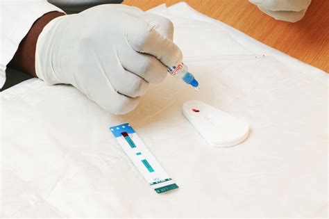 Hiv Tests Uses Side Effects Procedure Results