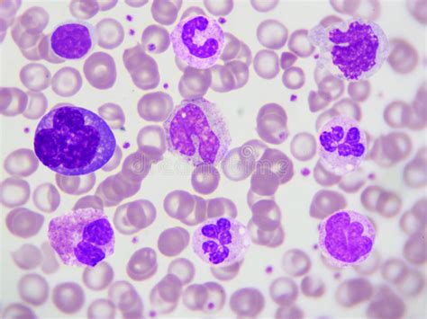 White Blood Cells Of A Human Photomicrograph Panorama As Seen U Stock