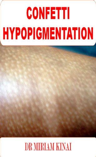 Dermatology Confetti Hypopigmentation Skin Diseases Book 25 Kindle
