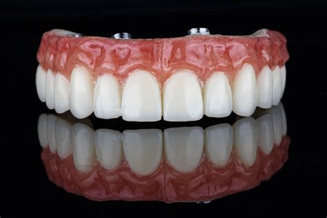 Prótesis Dental · Fijasremovibles · Antequera Bucoodontos