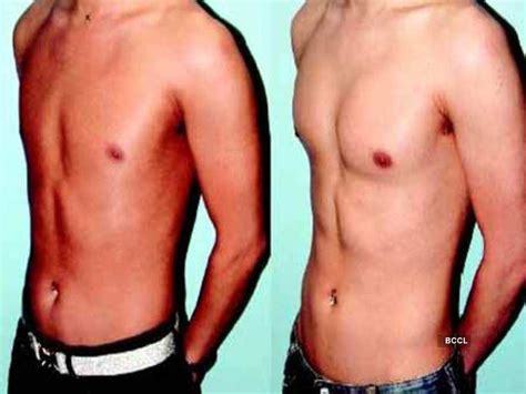 Butt Calf Implants For Men To Look Manlier Times Of India