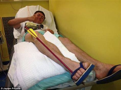 Man Shoots Himself In Leg With Crossbow And Then Hops 1km To Safety