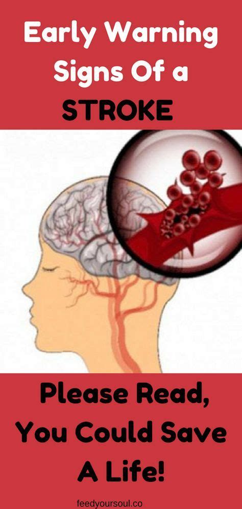 Early Warning Signs Of A Stroke Please Read You Could Save A Life