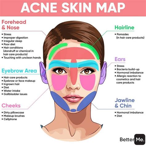 Whats Your Acne Saying About Your Health Healthylifestyle Added