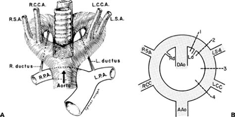 The Derivatives Of Aortic Arch Arteries A Schematics