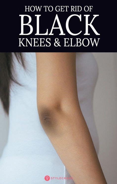 14 Home Remedies To Get Rid Of Dark Knees And Elbows Artofit