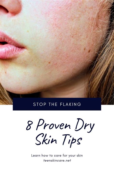 Dry Skin Tips Skin Tips Dry Skincare Skin