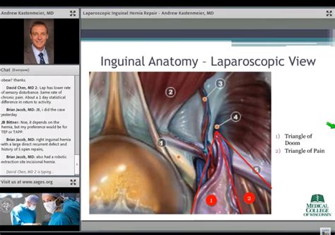Laparoscopic Inguinal Hernia Repair Anatomy Anatomy Structure The Best Porn Website