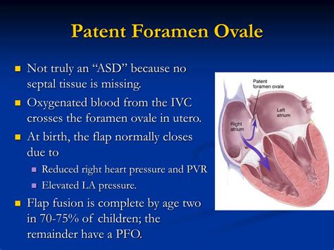 Ppt Atrial Septal Defects Powerpoint Presentation Free Download Id