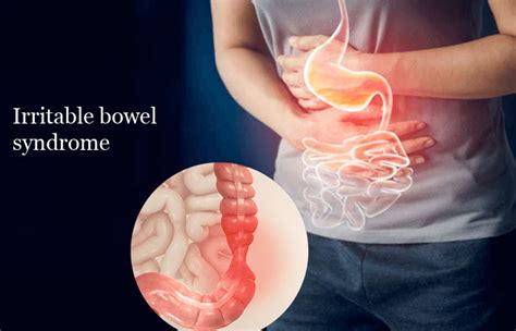 The Ultimate Guide To Treating Irritable Bowel Syndrome NewsTricky
