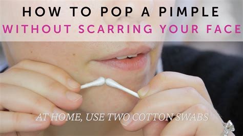How To Get A Pimple To Pop Without Popping It