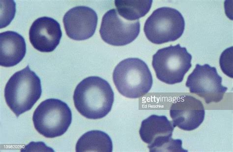 Blood Smear Micrograph Photos And Premium High Res Pictures Getty Images