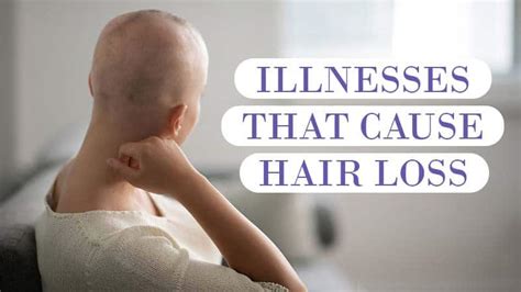 Illnesses That Cause Hair Loss You Should Be Aware Of