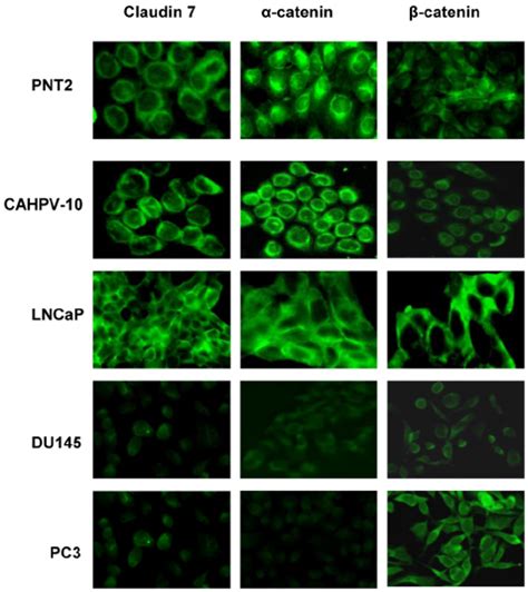 Fluorescence Images Of PNT And CAHPV Cells Show Membrane Bound Download Scientific Diagram