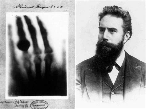 The Inventor Of X Ray And The First X Ray He Took Of His Wifes Hand