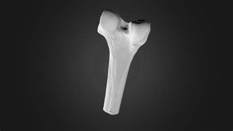 Femur Bone 3d Scan Download Free 3d Model By Metron3d B08fb3d