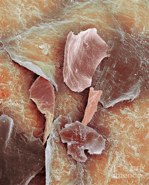 Dead Skin Photograph By Dennis Kunkel Microscopyscience Photo Library