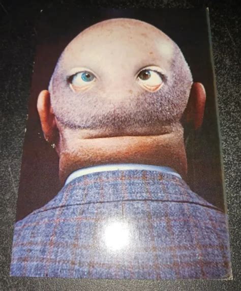 Vintage Eyes On Back Of Head By Alfred Gescheidt Photomontage Postcard