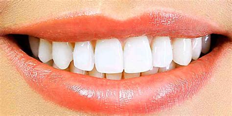 You Deserve A Beautiful White Smile Teeth Whitening