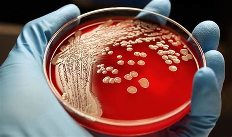 Antibiotics Resistant Superbugs To Kill 24million By 2050 Health