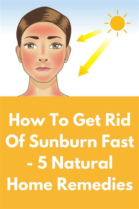 Keep sunburn cool w moist cool/cold compresses. How To Get Rid Of Sunburn Fast - 5 Natural Home Remedies ...