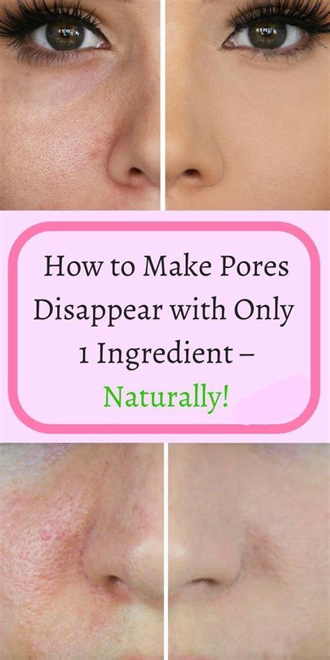 How To Get Rid Of Large Pores Homemade Remedies To Minimize Pores On