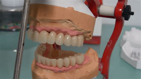 Implantologia dentale indolore atraumatica senza tagli e ...