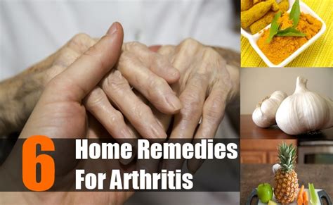 6 Home Remedies For Arthritis Natural Treatments Cure For Arthritis