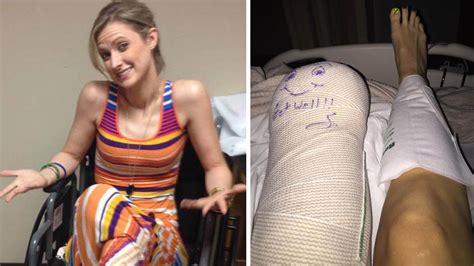Boston Marathon Survivor Inspiring Others After Having Her Leg