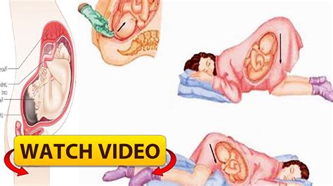 Proper Sleeping Position During Pregnancy You Must Know