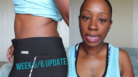 Tummy Tuck Update Week Incision Belly Button Shots Youtube