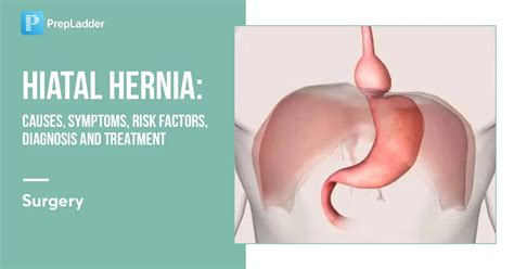 Hiatal Hernia Causes Symptoms Risk Factors Diagnosis And Treatment