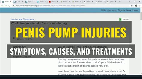 Penis Pump Injuries Symptoms Causes And Treatments Youtube