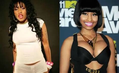 Nicki Minaj Breast Implants Plastic Surgery Before And After Celebie