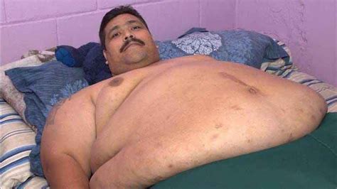 Fat pig like everywhere recreation, sport. At nearly 1000 lbs., world's heaviest man to undergo ...