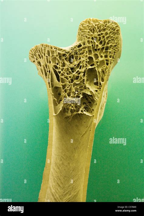 Cross Section Of Human Long Bone Showing Trabecula Bone Tissue Stock