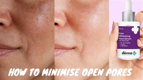 Skincare Routine To Minimise Open Large Pores Derma Co Pore