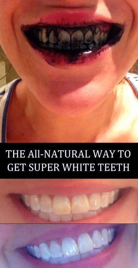 From payday deconstructed by alex yarmak. The All-Natural Way To Get Super White Teeth - My Favorite ...