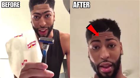 Anthony Davis Shaves His Unibrow Youtube