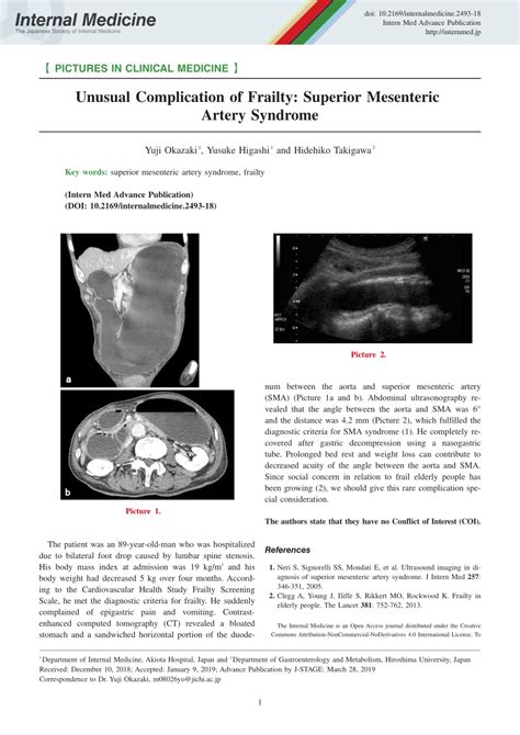 pdf unusual complication of frailty superior mesenteric artery syndrome